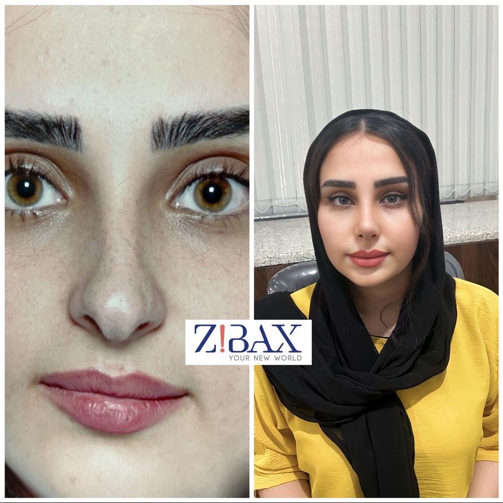 بهترین جراح بینی در شیراز