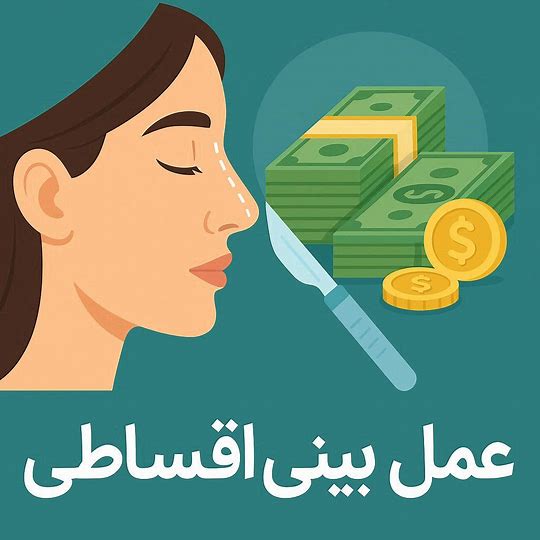 عمل بینی اقساطی