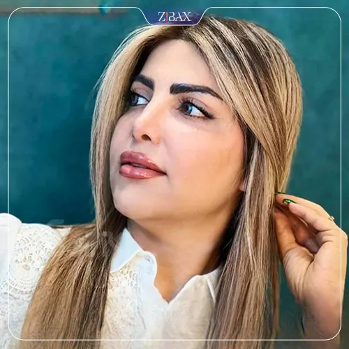 نمونه عمل جراحی بینی دکتر داریوش ساریخانی — تصویر 6