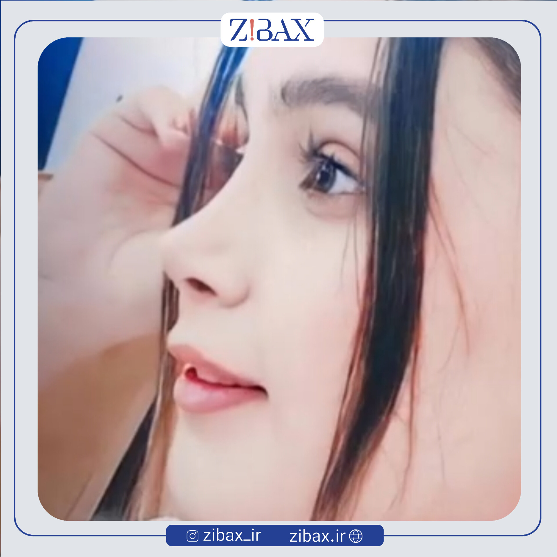 نتیجه جراحی