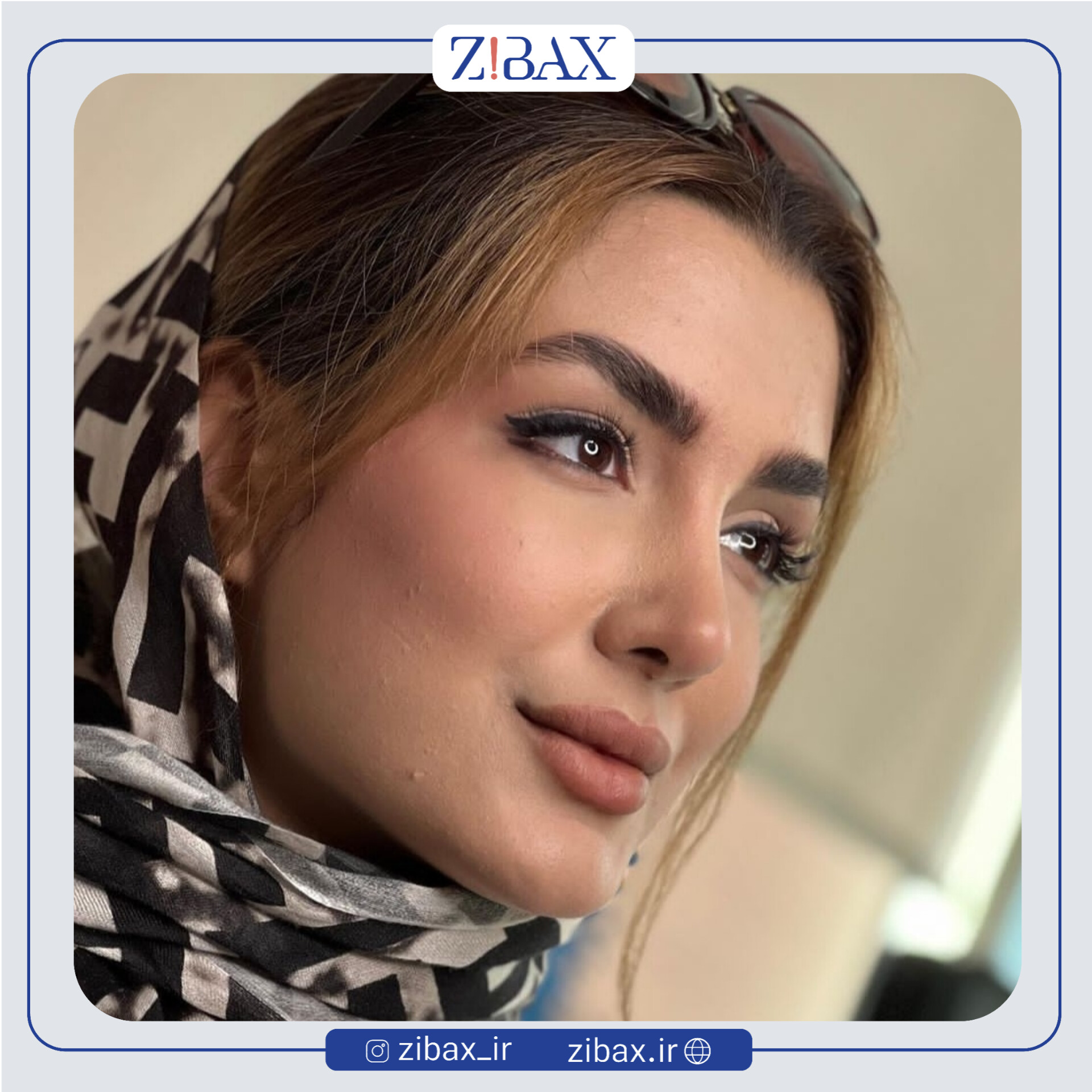 نتیجه جراحی