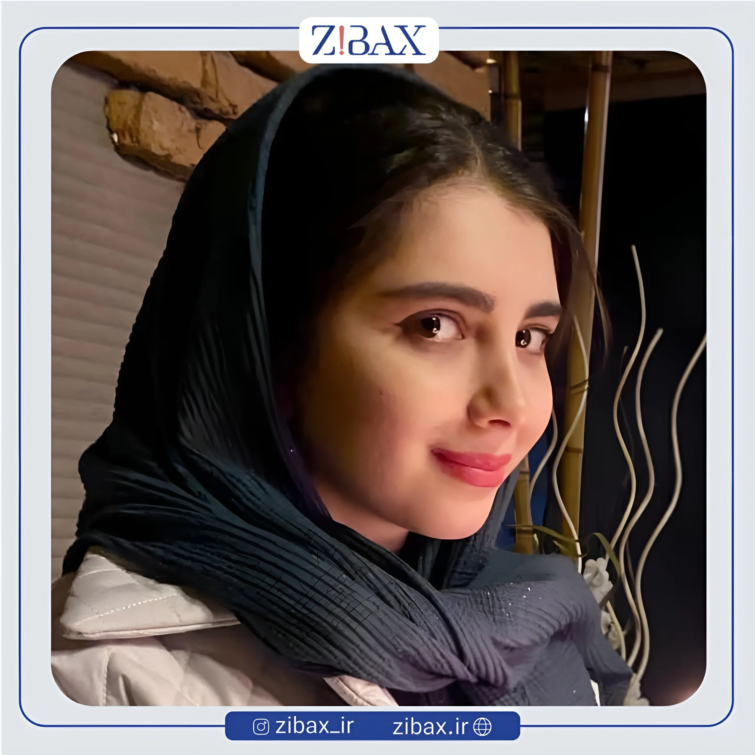 نمونه عمل جراحی بینی دکتر امیر دریانی — تصویر 1