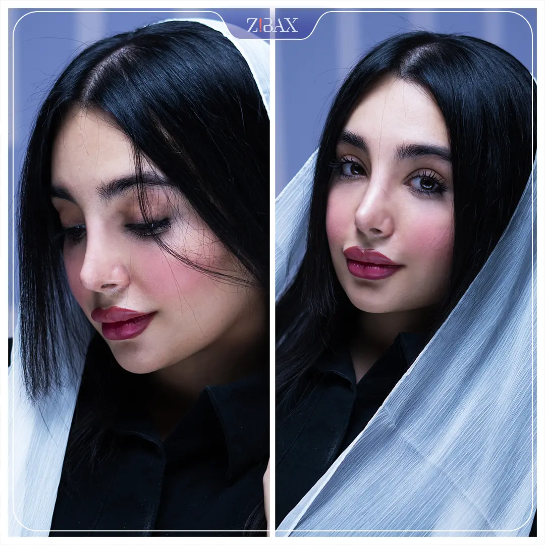 نتیجه جراحی