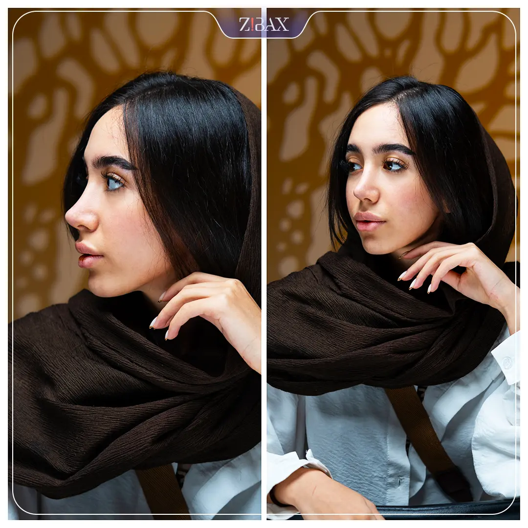 نتیجه جراحی