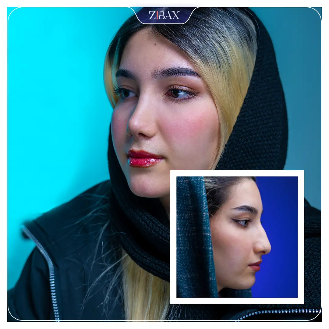 نتیجه جراحی