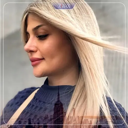 نمونه عمل جراحی بینی دکتر علیرضا محبی — تصویر 12