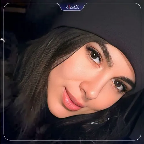 نمونه عمل جراحی بینی دکتر علیرضا محبی — تصویر 7