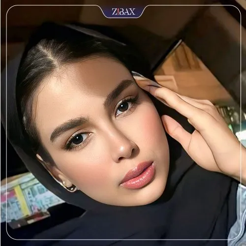 نمونه عمل جراحی بینی دکتر علیرضا محبی — تصویر 8