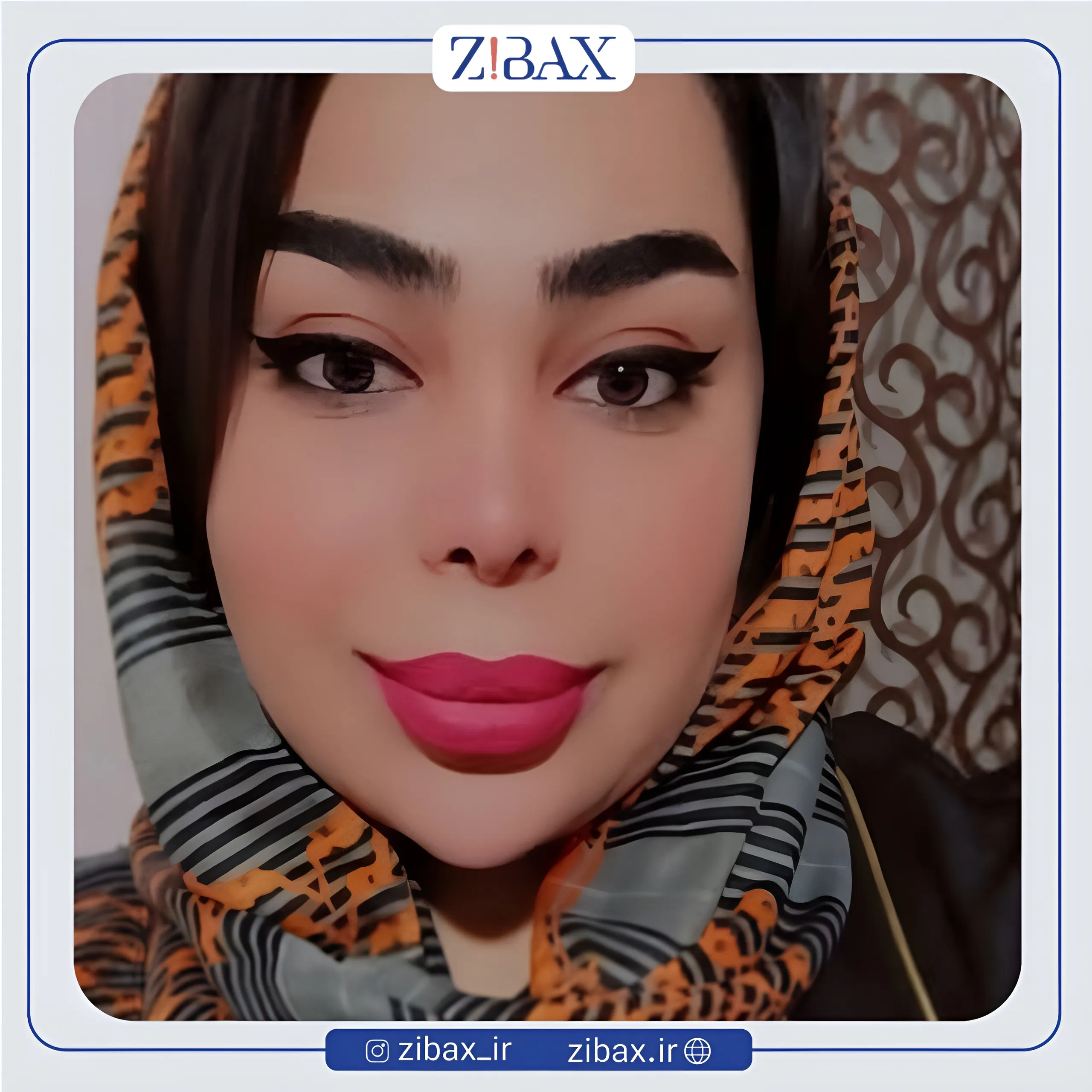 نمونه عمل جراحی بینی دکتر کاظم رشته احمدی — تصویر 9