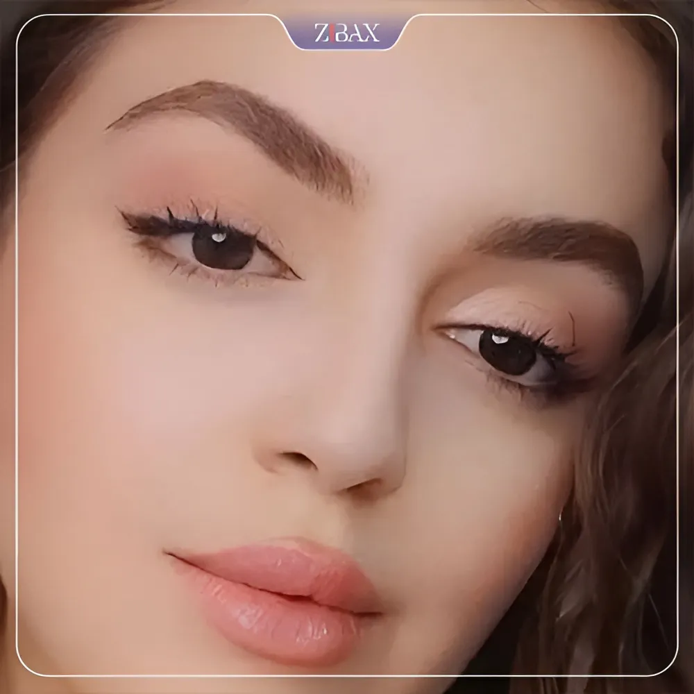 نمونه عمل جراحی بینی دکتر کاظم رشته احمدی — تصویر 8