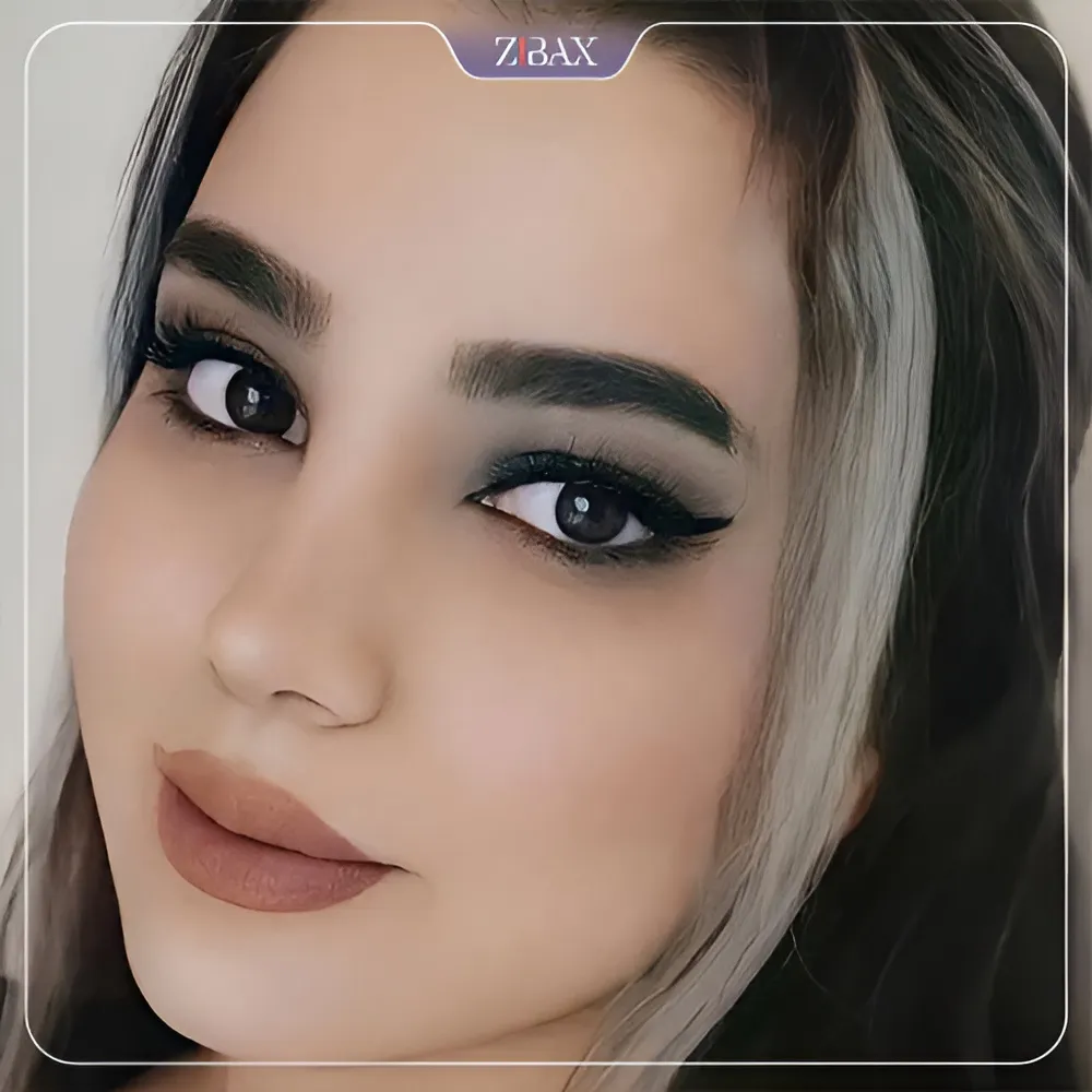 نمونه عمل جراحی بینی دکتر کاظم رشته احمدی — تصویر 5