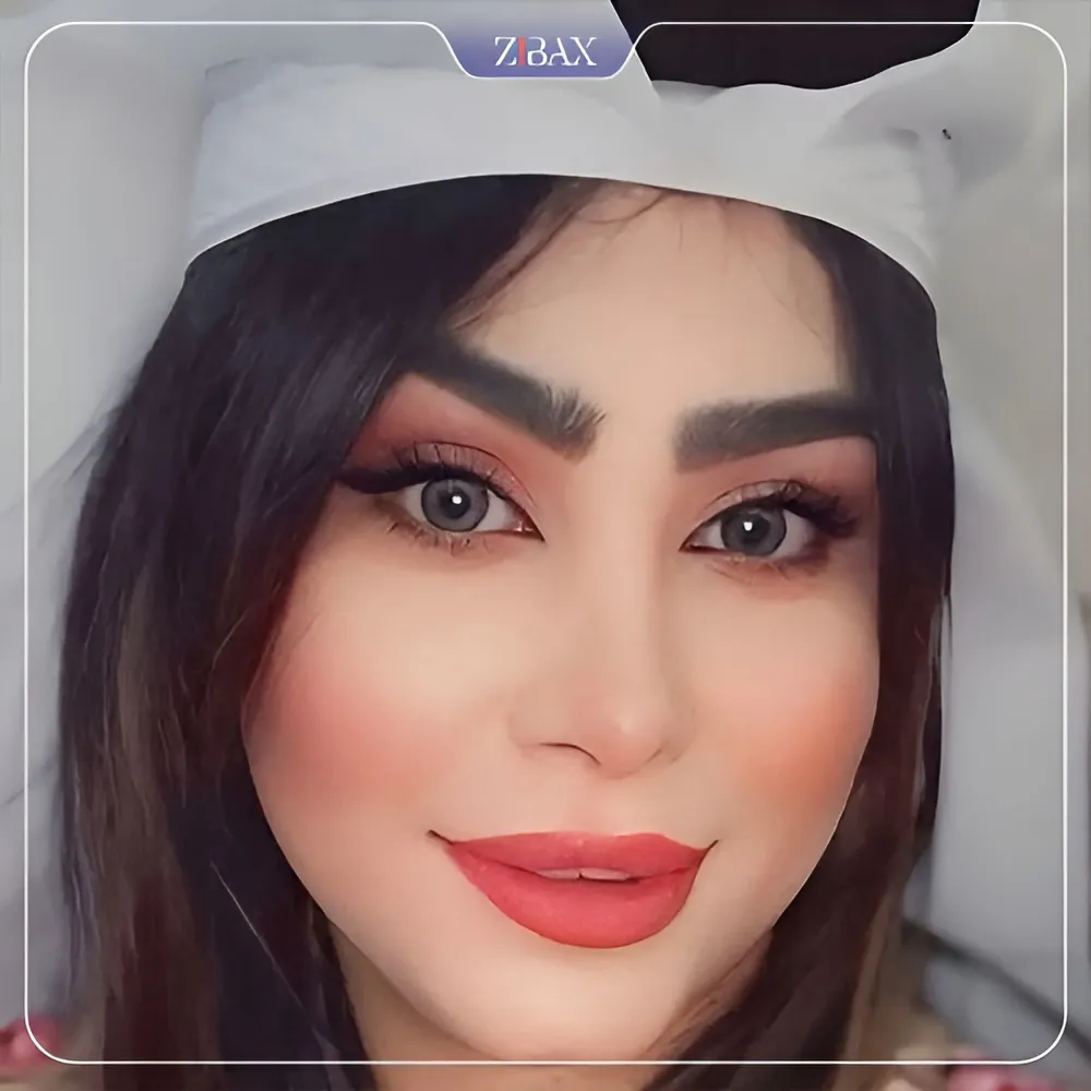 نمونه عمل جراحی بینی دکتر کاظم رشته احمدی — تصویر 4