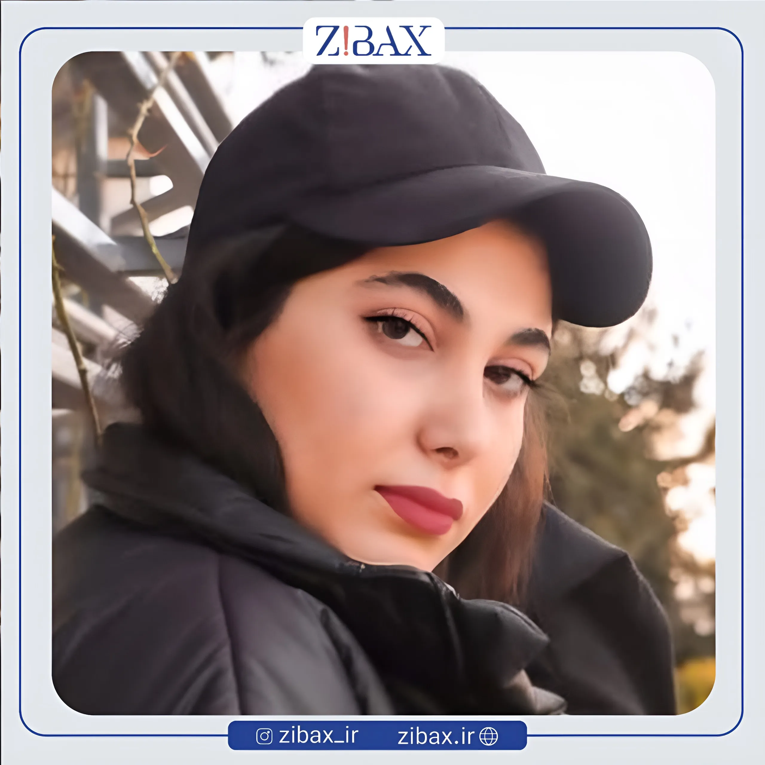 نمونه عمل جراحی بینی دکتر کاظم رشته احمدی — تصویر 2