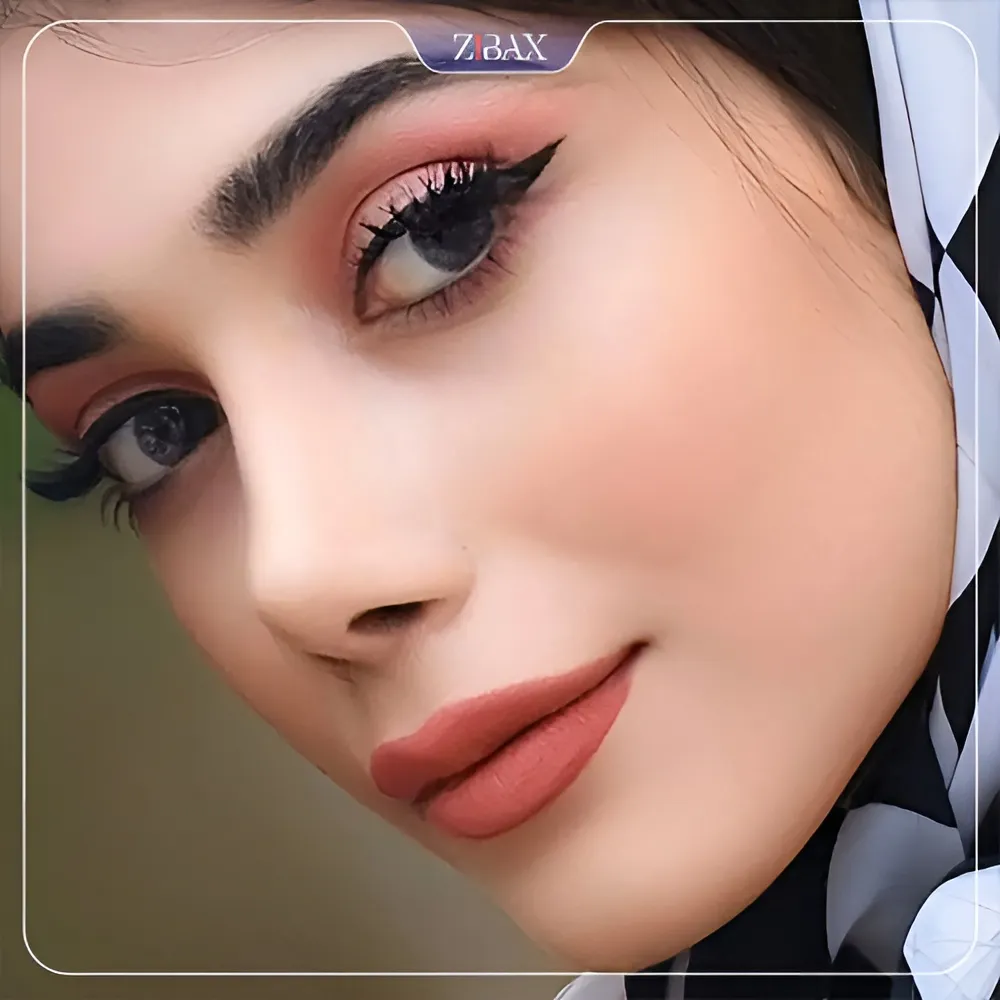 نمونه عمل جراحی بینی دکتر کاظم رشته احمدی — تصویر 10