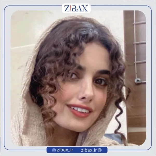 نمونه عمل جراحی بینی دکتر نگار جعفری — تصویر 4