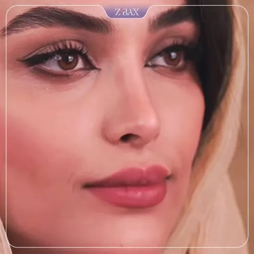 نمونه عمل جراحی بینی دکتر روزینا بشارتی زاده — تصویر 7