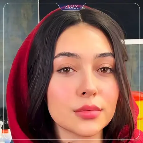 نمونه عمل جراحی بینی دکتر روزینا بشارتی زاده — تصویر 6