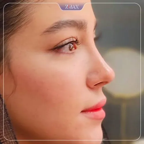 نمونه عمل جراحی بینی دکتر روزینا بشارتی زاده — تصویر 8