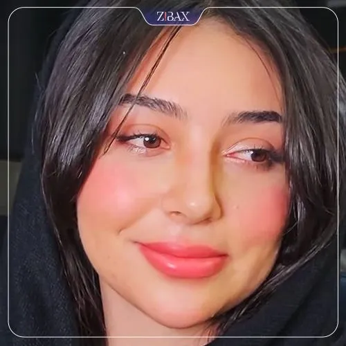 نمونه عمل جراحی بینی دکتر روزینا بشارتی زاده — تصویر 4
