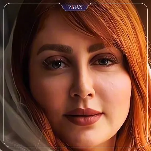 نمونه عمل جراحی بینی دکتر روزینا بشارتی زاده — تصویر 5