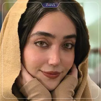 نمونه عمل جراحی بینی دکتر لیلا ملکی — تصویر 1