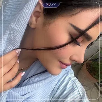 نمونه عمل جراحی بینی دکتر لیلا ملکی — تصویر 7