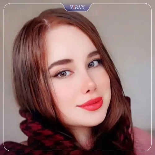 نمونه عمل جراحی بینی دکتر ادیب ملائی — تصویر 10