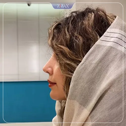 نمونه عمل جراحی بینی دکتر علیرضا مصباحی — تصویر 5