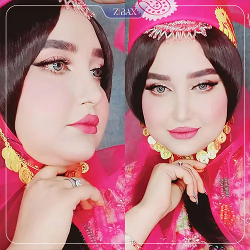 نمونه عمل جراحی بینی دکتر محمد مهدی ده بزرگی — تصویر 2