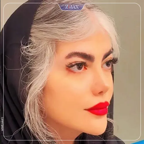 نمونه عمل جراحی بینی دکتر شهریار یحیوی — تصویر 8