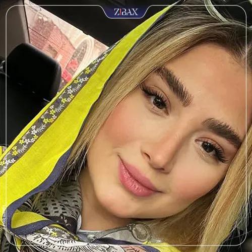 نمونه عمل جراحی بینی دکتر شهریار یحیوی — تصویر 2