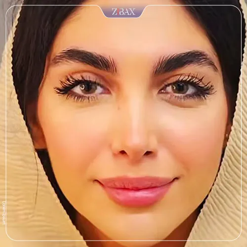 نمونه عمل جراحی بینی دکتر شهریار یحیوی — تصویر 9