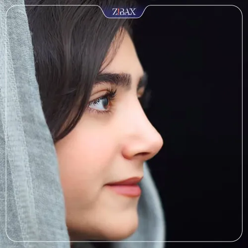 نمونه عمل جراحی بینی دکتر ابراهیم حاتمی پور — تصویر 10