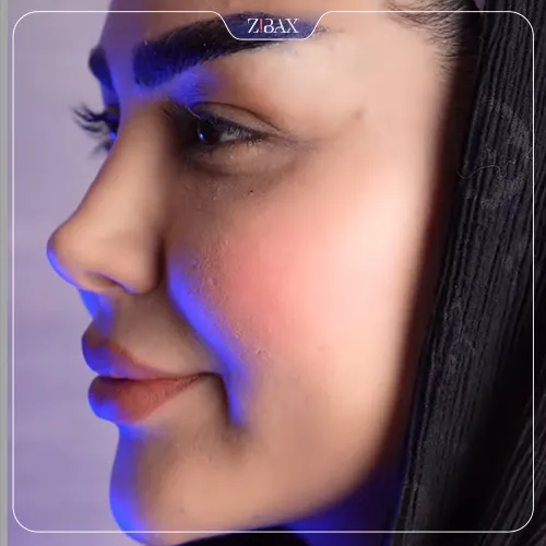 نمونه عمل جراحی بینی دکتر ابراهیم حاتمی پور — تصویر 6