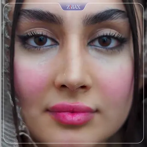 نمونه عمل جراحی بینی دکتر ابراهیم حاتمی پور — تصویر 4