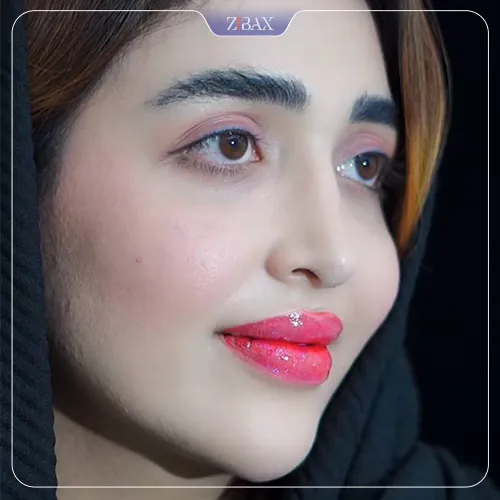 نمونه عمل جراحی بینی دکتر ابراهیم حاتمی پور — تصویر 3