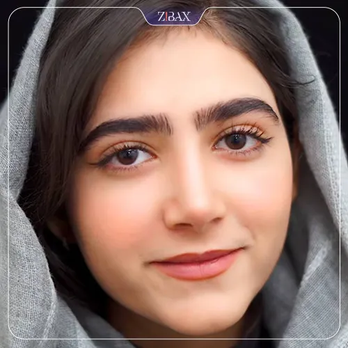 نمونه عمل جراحی بینی دکتر ابراهیم حاتمی پور — تصویر 7
