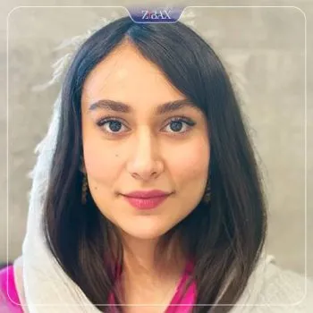 نمونه عمل جراحی بینی دکتر رویا جاویدی — تصویر 9