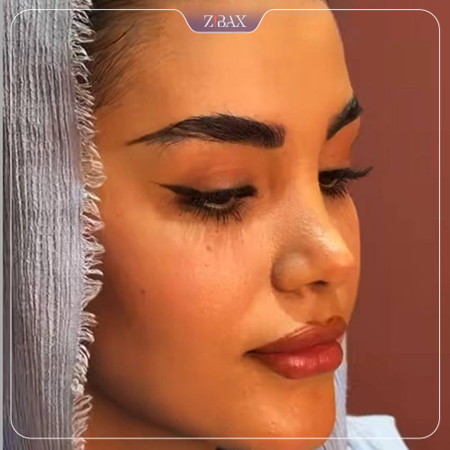 نتیجه جراحی