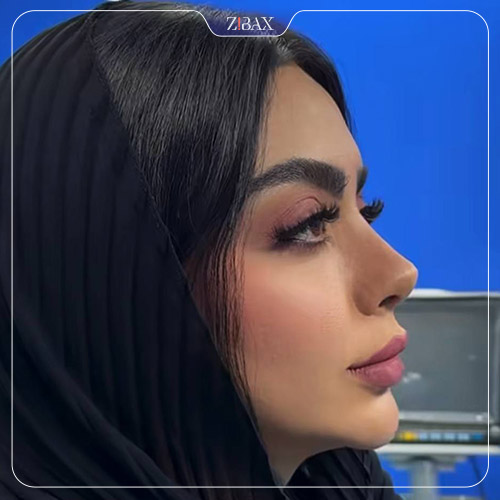 نتیجه جراحی
