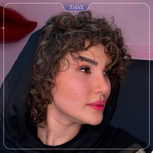 نمونه عمل جراحی بینی دکتر حمید نوری — تصویر 4