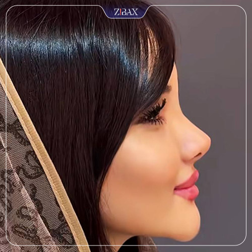 نمونه عمل جراحی بینی دکتر حمید نوری — تصویر 7