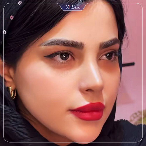 نمونه عمل جراحی بینی دکتر حمید نوری — تصویر 8