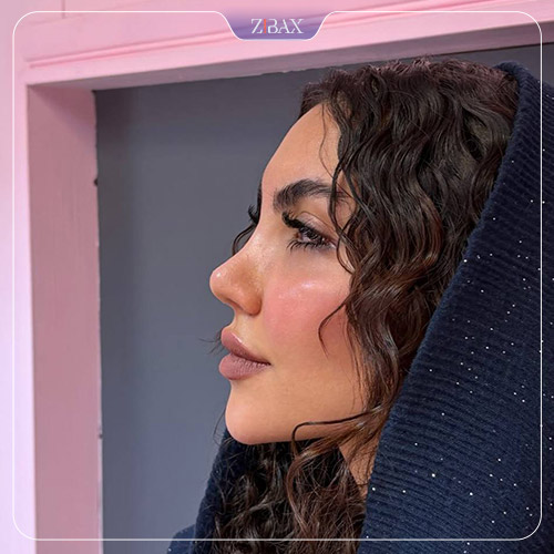 نمونه عمل جراحی بینی دکتر حمید نوری — تصویر 9