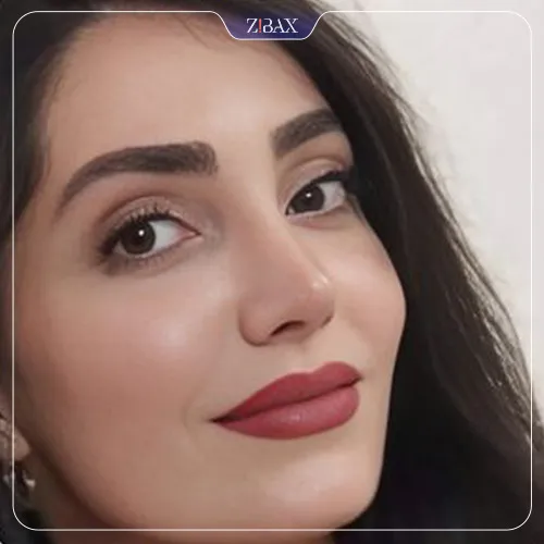 نمونه عمل جراحی بینی دکتر امید ابراهیمی — تصویر 6