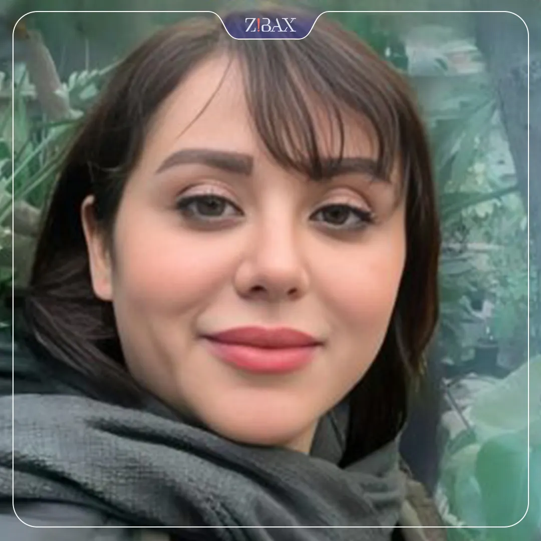 نمونه عمل جراحی بینی دکتر سجاد پیشگر — تصویر 2