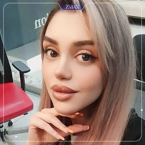 نمونه عمل جراحی بینی دکتر غلامرضا معین — تصویر 3