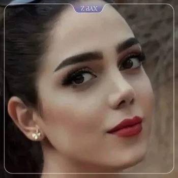 نمونه عمل جراحی بینی دکتر لیلا اسدپور — تصویر 4