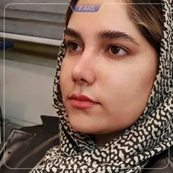 نمونه عمل جراحی بینی دکتر لیلا اسدپور — تصویر 7