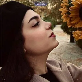 نمونه عمل جراحی بینی دکتر لیلا اسدپور — تصویر 8